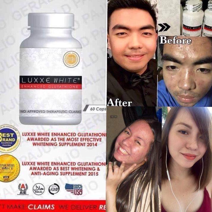 glutathione supplement brands Luxxe White Ultima Glutathione + Collagen 1400 mg 60 Capsules Suppleme – My  Care Kits main image 1