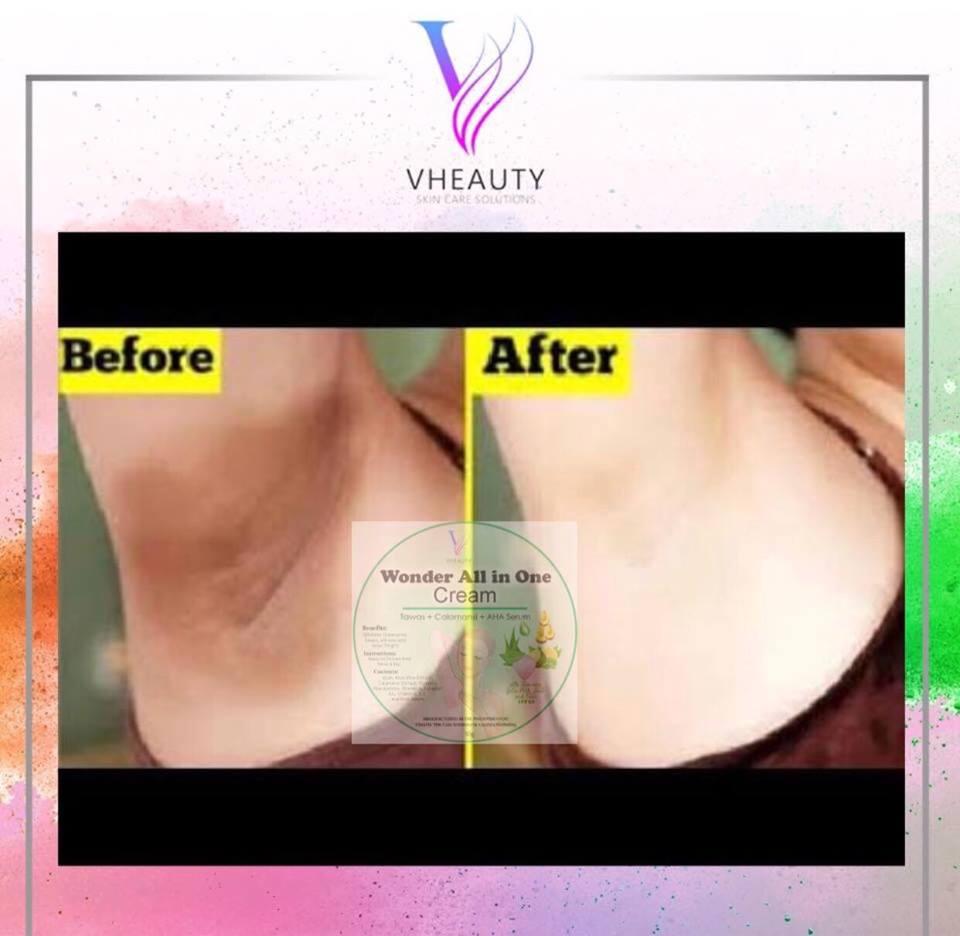 Vheauty Skin Care Solutions Wonder All Purpose Whitening Cream 100% Organic August 2018 - 3 Vheauty Skin Care Solutions Wonder All Purpose Whitening Cream 100% Organic - 3