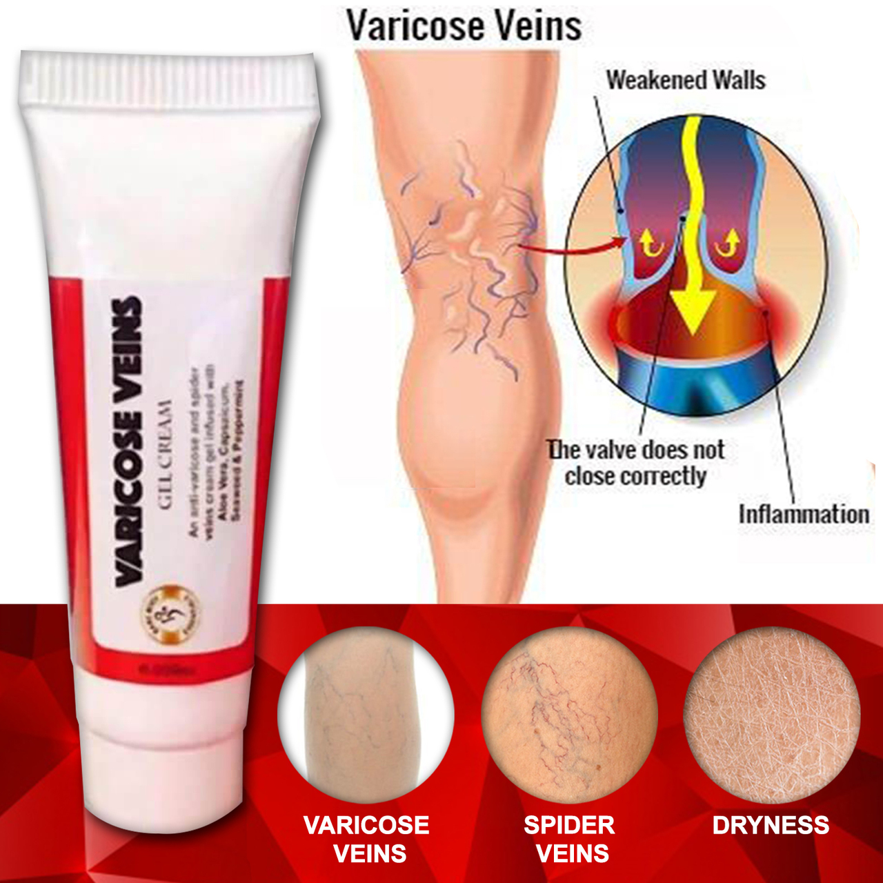 anti varicose cream anti varicose cream