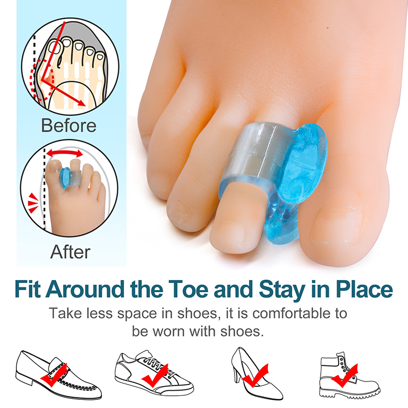 Có Được 2 Cái Silicone Bunion Hallux Valgus Protector Finger Toe Separator Divider Spreader Ngón Tay Cái Valgus Guard Feet Công Cụ Chăm Sóc Chân Big Toe Separator Xương Corrector...