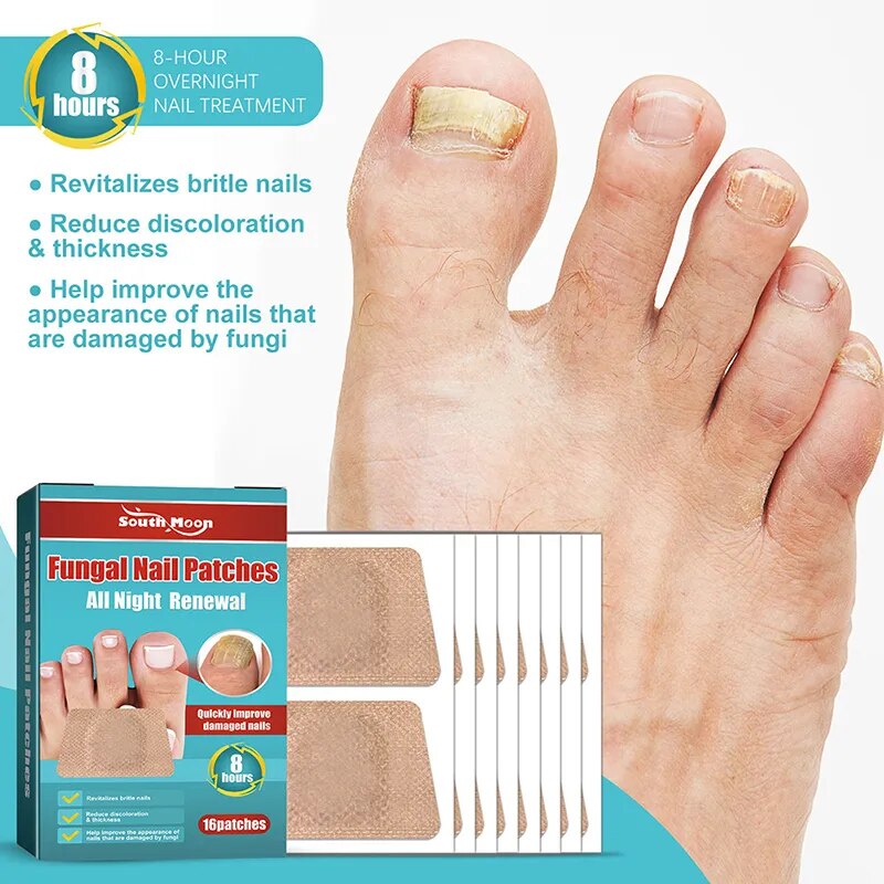 16Pcs Nail Treatment Patch Anti Fungal Nail Correction Stickers Ingrown Toenail Care Paronychia Anti Infection Repair Patch Care ราคา 106 บาท*ส่งฟรี