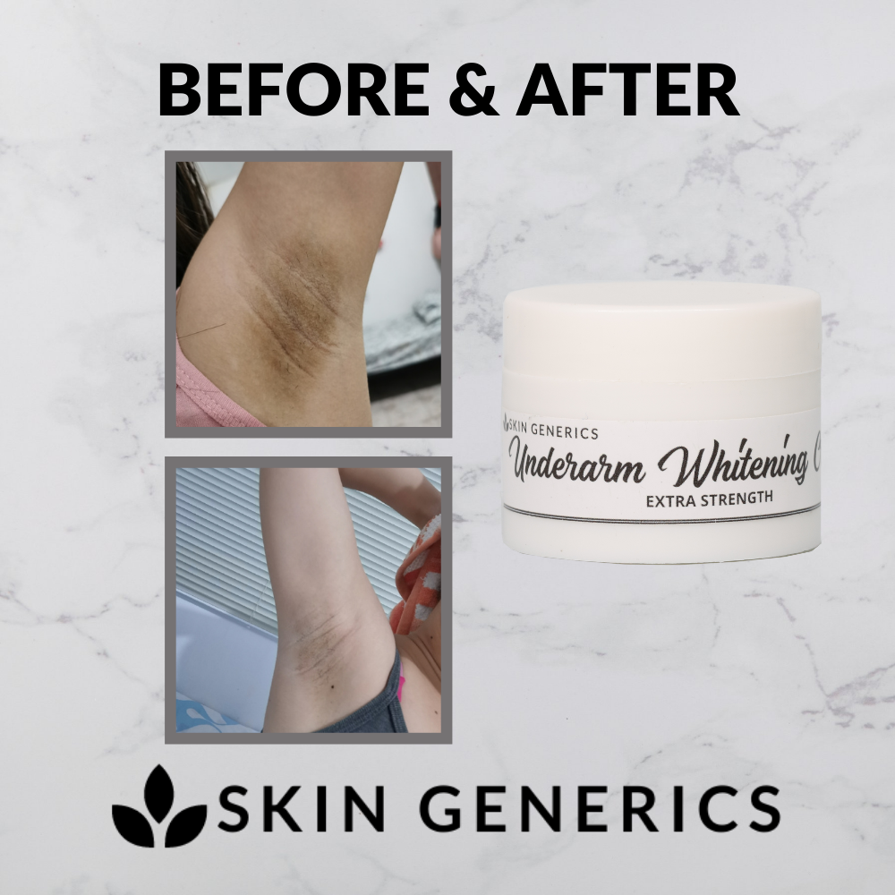 [ 5X UNDERARM WHITENING CREAM ] SkinGenerics Underarm Whitening Cream