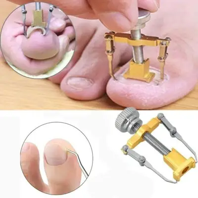 New Cuticle Pusher Professional Nail Recover Ingrown Toenail Correction Paronychia Foot Care Pedicure Tools Set (2)