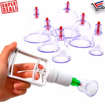 6 Pcs Set Pull Out Vacuum Apparatus Traditional Ventosa SelfTreatment At Home April 2018 - 2 6 Pcs Set Pull Out Vacuum Apparatus Traditional Ventosa SelfTreatment at Home - 2