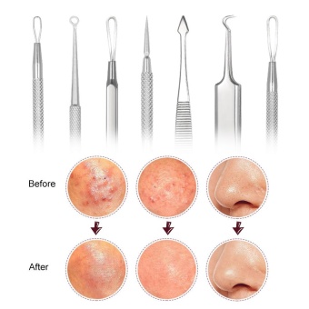 Abody 7pcs Blackhead Tool Acne Clip Facial Comedone Needle Set Facial Pimple Tweezer Stainless Steel Blemish Extractor - Intl July 2018 - 5 Abody 7pcs Blackhead Tool Acne Clip Facial Comedone Needle Set Facial Pimple Tweezer Stainless Steel Blemish Extractor - intl - 5