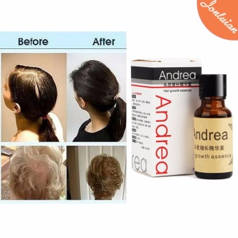 Andrea Hair Growth Essence Anti Hair Loss Hair Fall 20ml June 2018 - 4 Andrea Hair Growth Essence Anti Hair loss Hair Fall 20ml - 4