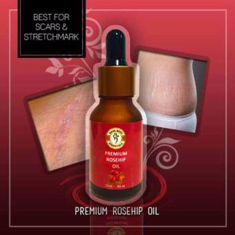 Bare Body Premium Rosehip Oil (15ml) Bundle Of 2 June 2018 - 2 Bare Body Premium Rosehip Oil (15ml) Bundle of 2 - 2