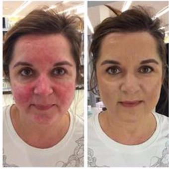 DERMACOL FOUNDATION 223 / SPF30 Hypoallergenic June 2018 - 4 DERMACOL FOUNDATION 223 / SPF30 Hypoallergenic - 4