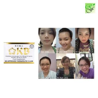 KB Glutanac With Rosehips Whitening Capsules June 2018 - 2 KB Glutanac with rosehips Whitening Capsules - 2