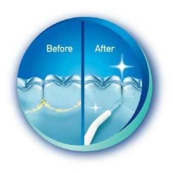 Power Whitening Flosser Oral Irrigator Electric Floss Pick DentalCare Water Jet Cords Tooth, Pick Braces - INTL June 2018 - 3 Power Whitening Flosser Oral Irrigator Electric Floss Pick DentalCare Water Jet Cords Tooth, Pick Braces - INTL - 3