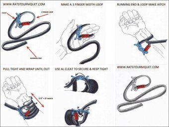 Outdoor Military Belt Stop Hike Emergent Kit Rescue Camp TraumaBleed Medical Bandage First Aid Survive Tourniquet Lifesave - Intl June 2018 - 3 Outdoor Military belt Stop hike emergent kit rescue camp TraumaBleed medical bandage first aid survive Tourniquet Lifesave - intl - 3
