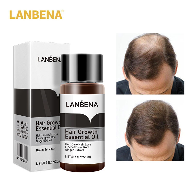 BUY 1 TAKE 1】LANBENA Hair Growth Essential Oil Hair Loss Treatment Prevent  Baldness Hair Grower for Men and Women Effective Hair Thickener Hair Care  20ml Hair Care 100% Pure Natural Treatment Hair