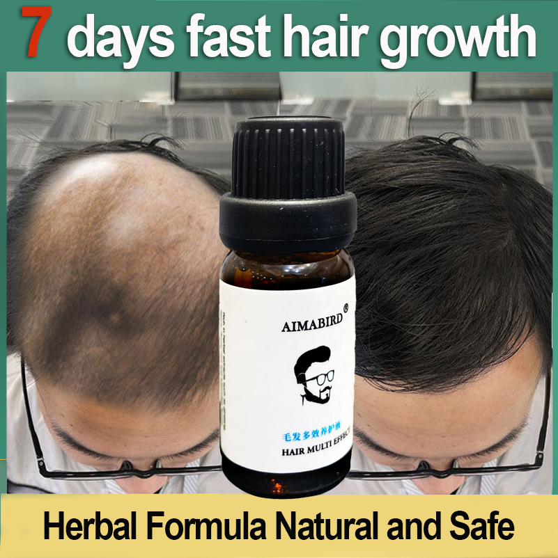 7 days fast hair growth hair growth liquid 10ml solve thinning problems  100% visible results 