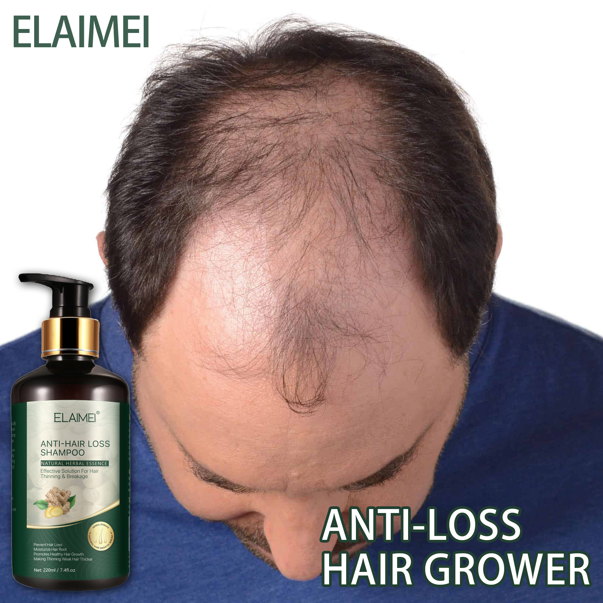 ELAIMEI Anti Hair Loss Shampoo With Ginger , Ginger Hair Growth Stimulating  Shampoo For All Types Of Hair , Improves Nutrient Supply and Strengthen The  Roots of The Hair , Hair Grower