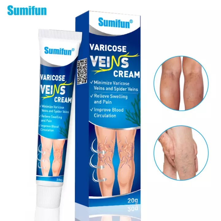 Varicose Gel Serum Relieve Pain Leg Swelling Remove Earthworm Legs