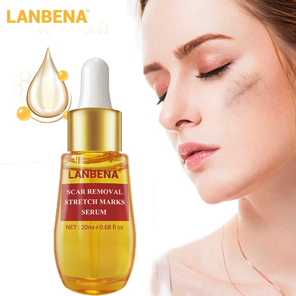 lanbena scar removal stretch marks serum watson
