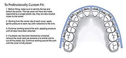 Clip On Comfort Lip Shield Mouth Guard For Braces Better Than