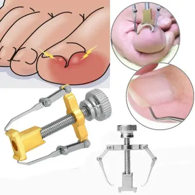 New Cuticle Pusher Professional Nail Recover Ingrown Toenail Correction Paronychia Foot Care Pedicure Tools Set (1)