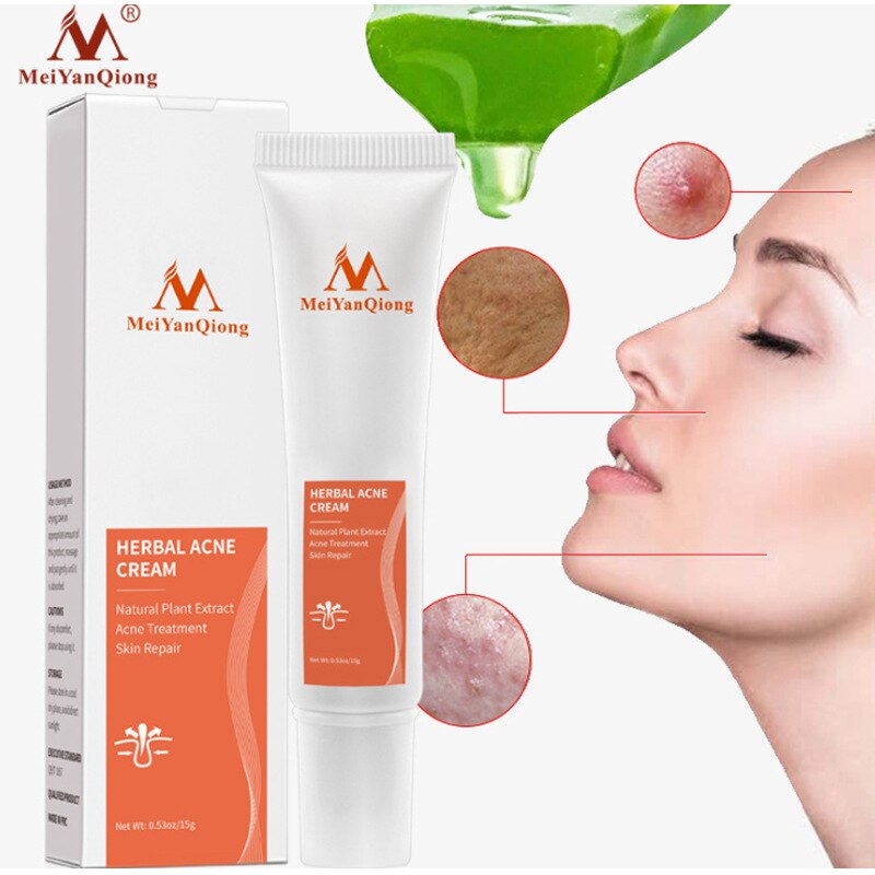 Meiyanqiong Acne Removal Cream Herbal Anti-Acne Repair Fade Acne Spots Oil Control Whitening Moisturizing Gel Skin Care 15G